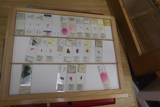 A wooden slide cabinet with selection of human biological slides